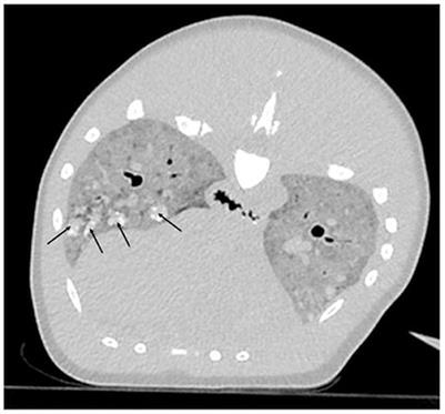 Case report: Sarcocystis speeri, Aspergillus fumigatus, and novel Treponema sp. infections in an adult Atlantic spotted dolphin (Stenella frontalis)